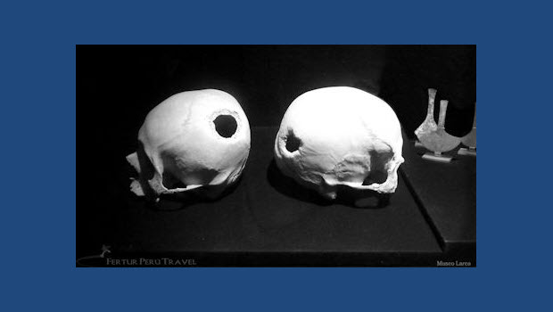 Tour the Larco Museum to see evidence of ancient brain surgery